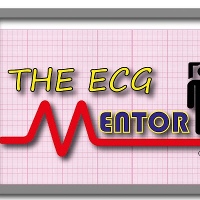 The ECG Mentor 🩺🫀🚑