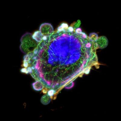 Promoting science by StemCell art🌏 Biologist(Stem cell &Mrchano-biology)🧫 Microscopist🔬Dentist🦷 PhD @UiB MSc @KingsCollegeLon