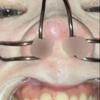 nosefetish (@nosehooknose) 's Twitter Profile