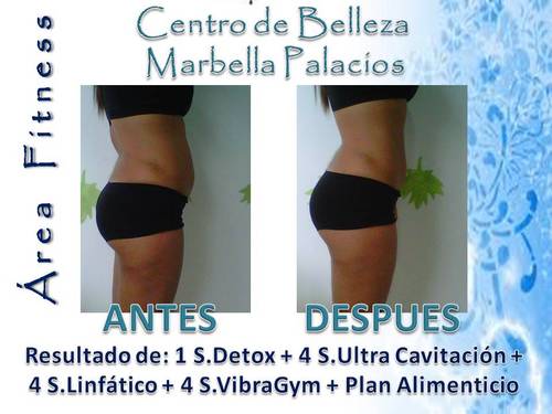 MarbellaSalonFt's profile picture. Centro de Belleza y Bio- Medicina Estetica - Especializado en Control de Talla, Peso, y Cuidado del Cabello; personal internacional