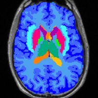 Advanced Clinical Imaging Technology - ACIT (@acit_research) 's Twitter Profile