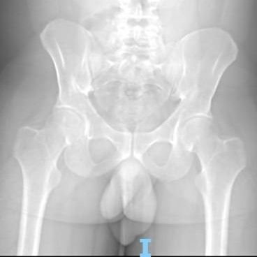 MiGenital's profile picture. Soy una mente Brillante.
Humor: Concha, pito, caca, culo.