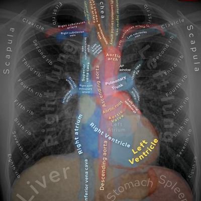 Interventional Pediatric Cardiologist  and  Scuba Diver #McGillu #Stollerykids #CHD  🇴🇲🇨🇦🇬🇧