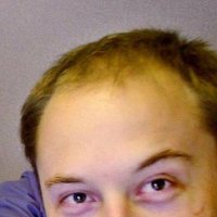 ElonGated Forehead(@KillianO) 's Twitter Profile Photo