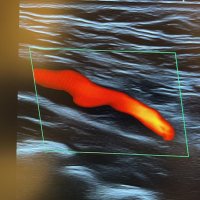 VascularDoppler (@consejovascsac) 's Twitter Profile