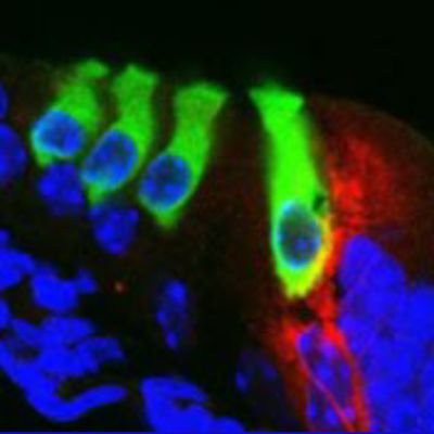 Neuropathology of Hearing and Myelinopathies Group