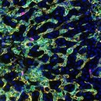 The Stevenson Lab at UTMB (@hlstevensonlab) 's Twitter Profile