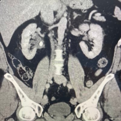 Chefarzt Urologie, Kinderurologie und Urogynäkologie, Krankenhaus Maria Hilf, Krefeld #CHTC#Effzeh#AHC#SCM