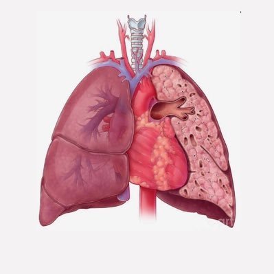 Welccome , this account is your destination for respiratory therapy. @sahar_2020_