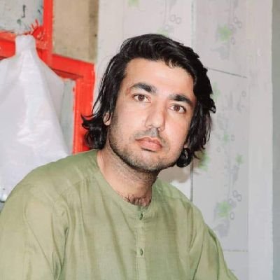 زه د BMD ناروغ يم
تاسو راسره د دې ناروغۍ په علاج کې څه مرسته کولى شئ
واټس آپ 0785192021