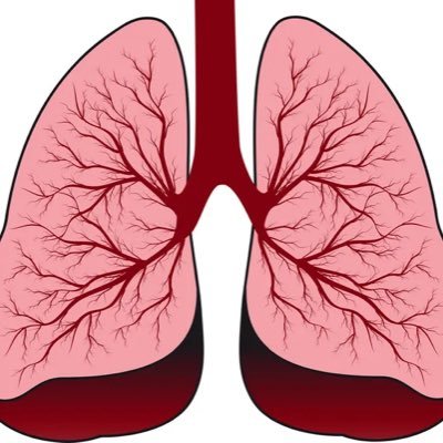 PneumologiaGirona_ICS_IAS