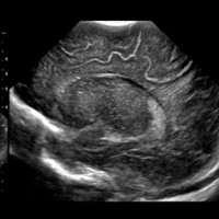 NeonatalPOCUS(@pocus_neonatal) 's Twitter Profile Photo