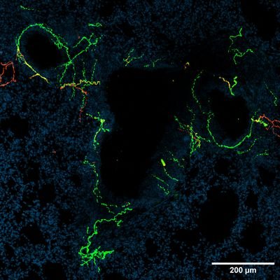 PhD student in @talbot_lab. Sensory neurons enthusiast. Interested in mechanisms of neuro-immune crosstalk during inflammation.