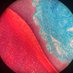 A Pathologist (@anatomicpath) Twitter profile photo A Pathologist (@anatomicpath) Twitter profile photo
