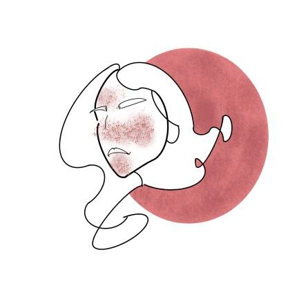Red Social creada para conectar las personas que padecemos esclerosis tuberosa. Un espacio donde poder compartir nuestras vivencias.