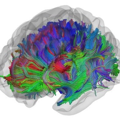 Epilepsy research conducted in collaboration between @LivUni and @WaltonCentre. Epilepsy imaging research lab: @BrainImagingLiv