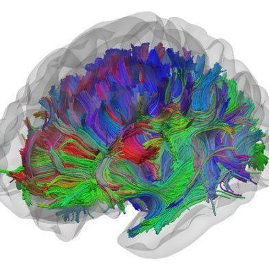 epilepsy_liv's profile picture. Epilepsy research conducted in collaboration between @LivUni and @WaltonCentre. Epilepsy imaging research lab: @BrainImagingLiv