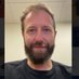 Danny Galloway (@pbendoscopy) Twitter profile photo Danny Galloway (@pbendoscopy) Twitter profile photo