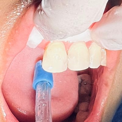 dental life 🦷