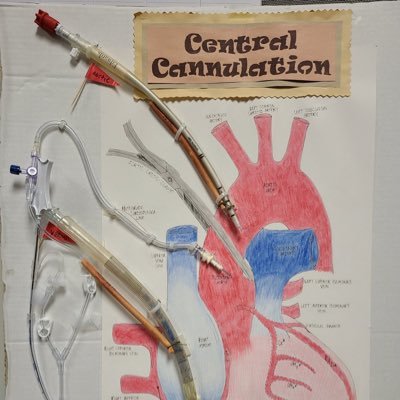 Anestesia cardio torácica y Ecocardiografía Perioperatoria. POCUS-Cuidado Crítico Cardiovascular. Clínica Auna Las Américas - Hospital Pablo Tobón Uribe