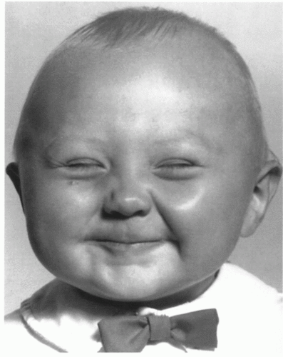 Kevin Samuel (FFS Hoyle - get a grip!)