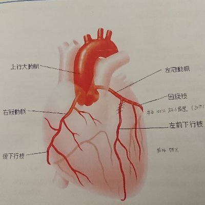 自動車関連のベンチャー企業で某大手本社と不動産会社に勤務のうえ独立 渉外のプロ 2020年に2度目の心筋梗塞(死亡率約70%)を奇跡的に乗り越えたが心筋の一部が壊死して心臓の稼働率40%以下 見た目では判別出来ないが障害者手帳所持 コロナで同じ事起きるよ。コロナワクチン8回インフルエンザワクチン接種済 天安門事件