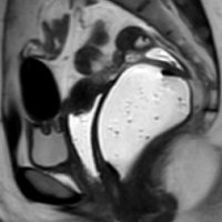 SAR-PelvicFloor-DFP (@sarpelvicfloor) 's Twitter Profile Photo