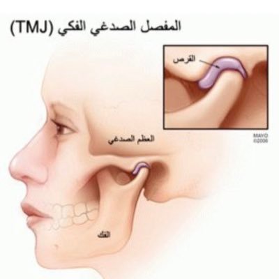 Orofacial Pain and beyond by @shrouqabdulaziz