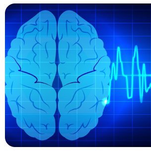 Neurophysiology Research is a peer-reviewed, open access, scientific journal that aims to disseminate the latest research findings in neurophysiology