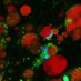 Rheumatology Lab CHUV UNIL (@rheumalab_chuv) Twitter profile photo Rheumatology Lab CHUV UNIL (@rheumalab_chuv) Twitter profile photo