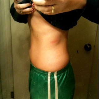 xmakemethinx's profile picture. Nothing tastes as good as skinny feels. I'm 17. Ednos, self harm, bipolar. Pro-Ana/Mia 5'11 CW: 176 lbs. GW1: 165 lbs. GW2: 150 lbs. UGW: 125 lbs.