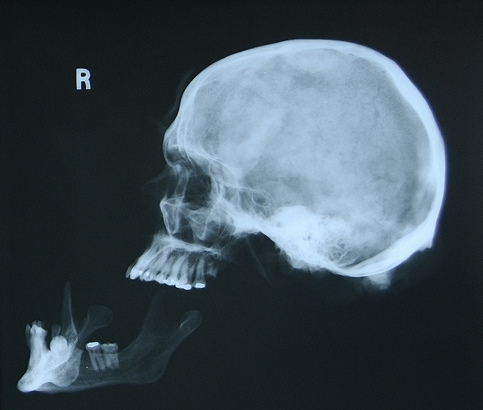 finaldx's profile picture. Forensic pathologist and forensic neuropathologist