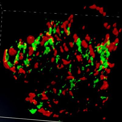 The Veeraraghavan lab applies cutting-edge light and electron microscopy to understand how nanoscale structure affects the heart's rhythm in health and disease.