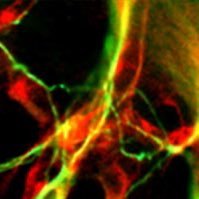 Heuckeroth Lab (@heuckerothlab) 's Twitter Profile