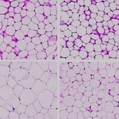 Neuroendocrinology Lab interested in #energyhomeostasis, #adiposetissue, #islets, #brain, inter-organ #crosstalk in #obesity, #diabetes @UNSW @ANZOS_Society