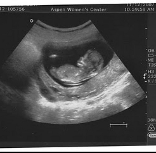 HeartBreakerJr's profile picture. He lied about his cooking skills.. Two eggs, some milk, a sausage, into the oven & mum's full for 9 months!