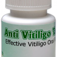 Antivitiligotabs