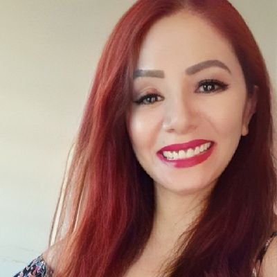 O que você tem de diferente é o que você tem de mais bonito. 💓
Se ame se cuide!
E