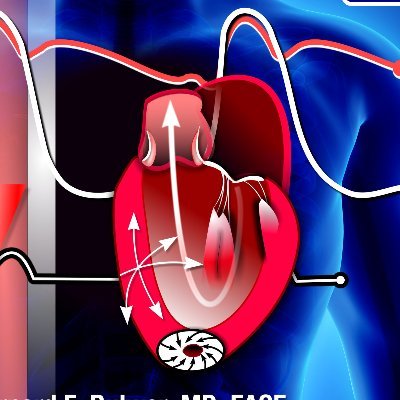 Cardiology Point-of-Care Ultrasound Solutions: Integrating Hardware, Software, Artificial Intelligence, Education, and Training: The EchoScope Project