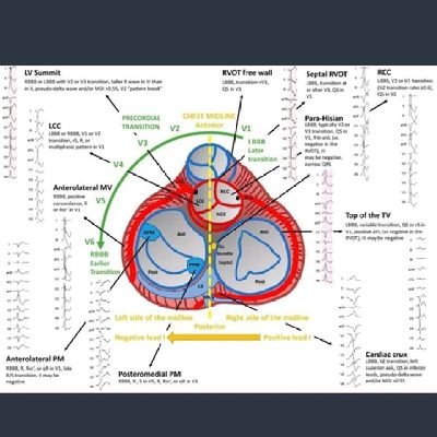 Very junior cardiology resident ! Cardiology/ICU/hemodynamics enthusiast !
