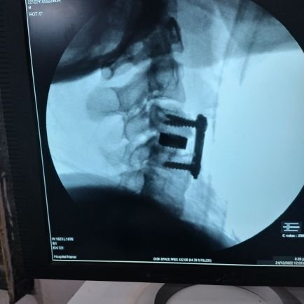 gauravm99112361's profile picture. MS(BJMC Ahmedabad),DNB(Delhi), SPINE SURGEON
FNO trader..