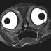 Radilologist (@radil0logist) Twitter profile photo Radilologist (@radil0logist) Twitter profile photo