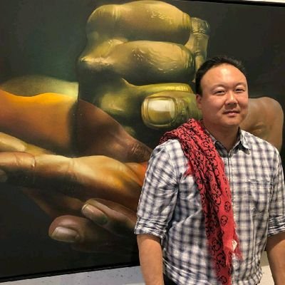 Orthopedic surgeon . Empowered millions to take control of their health. Father of 1.
Knee Replacement / Hip Replacement
Email:drzhangwei43@gmail.com