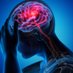 Journal of Experimental Stroke & Translational Med (@journalofexper2) Twitter profile photo Journal of Experimental Stroke & Translational Med (@journalofexper2) Twitter profile photo