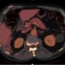 Emerg Radiology Pioneers (@er_pioneers) Twitter profile photo Emerg Radiology Pioneers (@er_pioneers) Twitter profile photo