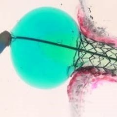 FLASHTRUE360's profile picture. FLASH = 1st & only 2-in-1, dual-balloon catheter system designed for TRUE 360 stent apposition + total lesion coverage in coronary and peripheral ostial cases.