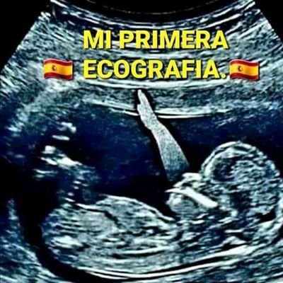 🇪🇦🇪🇦🇪🇦Muy Facha.🇪🇦🇪🇦🇪🇦
Convencido que un comunista necesita 15 meses de embarazo. Con 9 salen a medio hacer y después lo sufrimos todos.