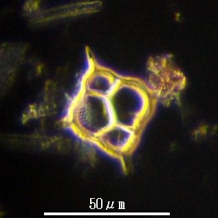 気が向いたときに微生物(化石も含む)などの写真で遊んでいます。
今のところ顕微鏡写真が主体です。