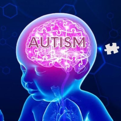 CONFERINȚA: Schimbare de paradigmă în autism. Autismul - cauză sau efect al altor tulburări.