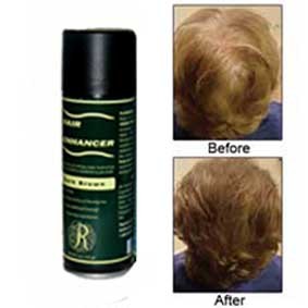 Knight Distributing manufactures great products for people with thinning hair.  Our website is http://t.co/eOCaiil5io, or visit us at http://t.co/XNRyqTHV5A.